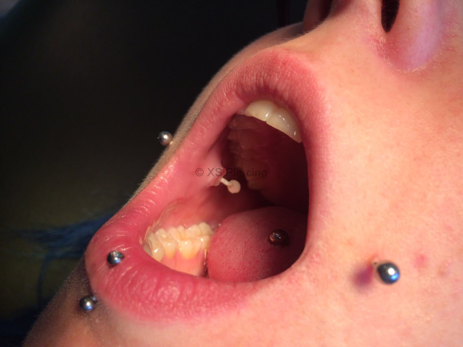 Cheeks-Piercing mit Dimple-Effekt